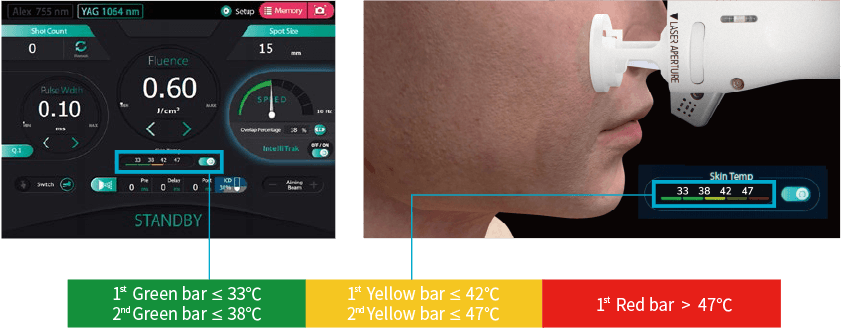 リアルタイムで皮膚の表面温度を計測しながら、レーザーを照射することで皮膚を火傷から守ります。